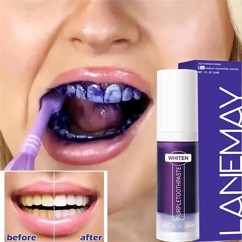 V34 Purple Whitening Toothpaste – Instant Yellow Tone Neutralizer