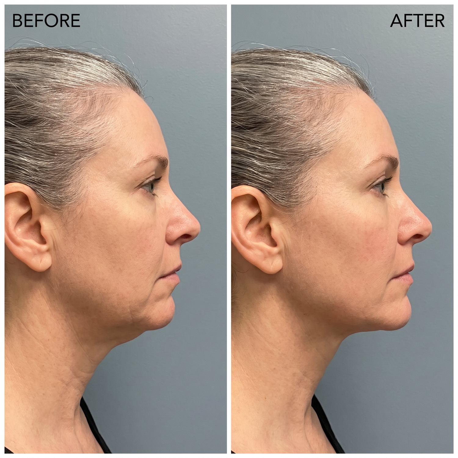 Lunéa : Lift. Firm. Rejuvenate in 5 minutes a day